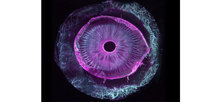 Première mondiale : des chercheurs réussissent à rendre un œil humain entièrement transparent